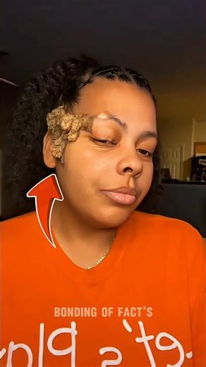 This Brain-Like Growth on the Head Isn’t a Brain 😳