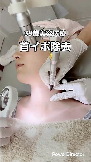 【美容医療】首イボ32個除去してきました！
