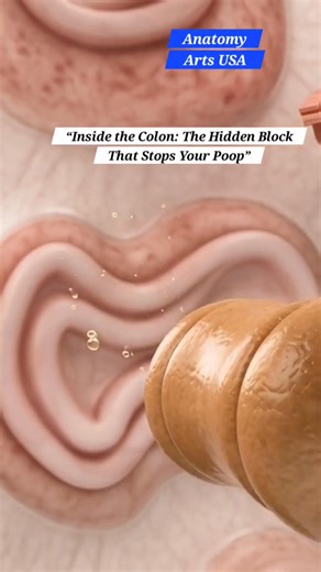 Inside the Colon | The Hidden Block That Stops Your Poop | Gut Health | Anatomy Arts USA | Anatomy Arts