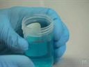 Blue Urine | Untold Stories of the ER