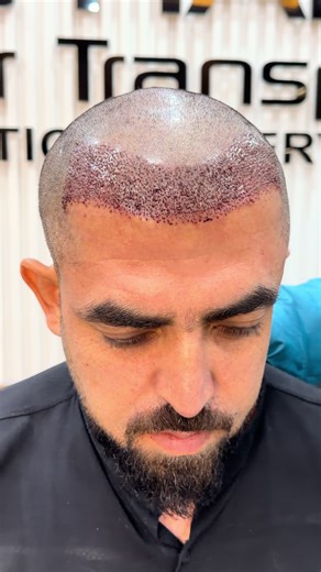 Expert Insights from Dr. Ahmed Khan, Plastic Surgeon