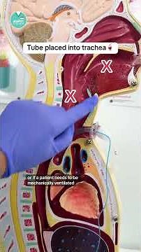 Tracheostomies Explained #RN #BSN #futurenurse