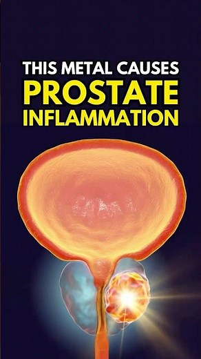 This Metal Causes Prostate Inflammation