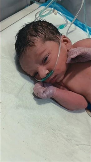 Preterm Newborn with Cyanosis | Emergency NICU Care