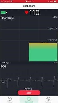 ViHealth app - using ViAtom chest strap to measure heart rate