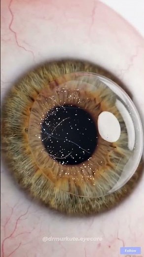 Why Do Styes Form on the Eyelid? | Explained by Dr Dipti Murkute