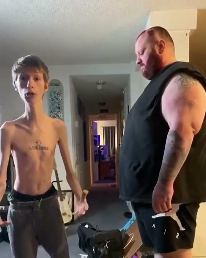 Daddy long neck - THE SLAP THAT CHANGED MY LIFE