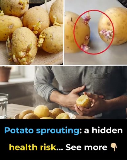 335K views · 332 reactions | 凜 Potato sprouting: a hidden health risk… See more  | Feedy Video | Facebook