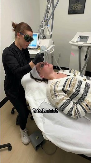 BBL Laser Treatment for Face - Follow to see Before and After BBL