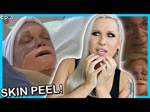 The Truth about Chemical Skin Peels! Dr 90210 (S01E03 Reaction) ‪@Luxeria‬