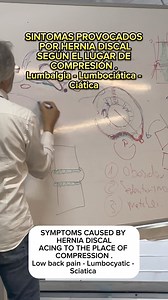 16K views · 405 reactions | SINTOMAS PROVOCADOS POR UNA HERNIA DISCAL SEGÚN EL LUGAR DE COMPRESIÓN : LUMBALGIA - CIÁTICA Ó LUMBOCIÁTICA . // SYMPTOMS CAUSED BY A HERNIATED DISC ACCORDING TO THE PLACE OF COMPRESSION: LUMBALGIA - SCIATICA OR LUMBOSCIATICA. // #herniadedisco #discherniated #lumbalgia #herniateddisc @atakoyfiziktedavi | Juan José Boscá Gandía | Facebook