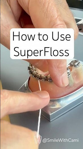 How to Floss Under Braces, Retainers, and Bridges with Superfloss