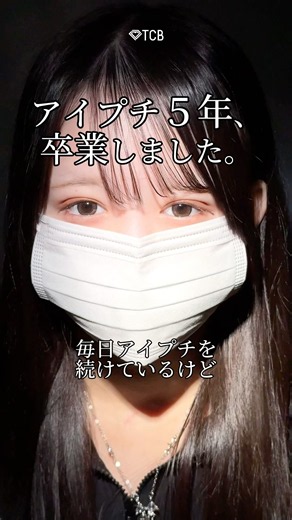 [Double Eyelid Surgery] 5 years of using eyelid glue, I'm finally done with it. #shorts