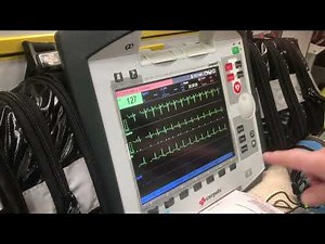Corpuls C3 ECG - This is my heart beat