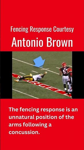 Fencing Response Courtesy Antonio Brown