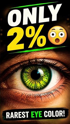 Rare Green Eyes 😳