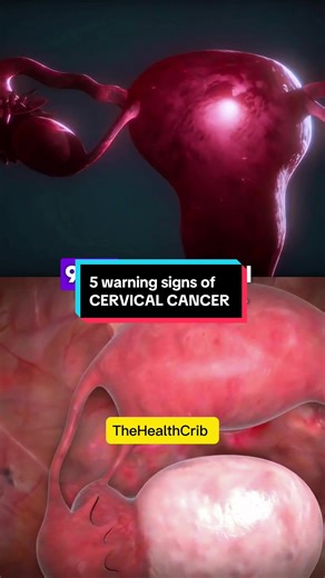 5 Warning Signs of Cervical Cancer Every Woman Should Know