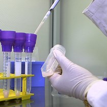 Isolation and Culture of Microglia - JoVE Journal