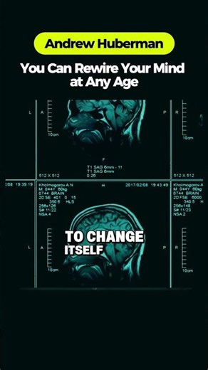 Your Brain Was Designed to Change