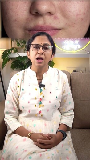 This flower fixes angry skin