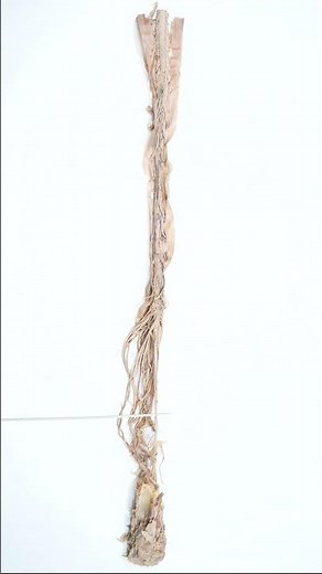 Filum terminale of spinal cord