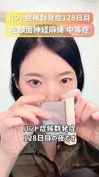 【発症128日目】閉じない麻痺目の完全封鎖手順👁️🩹 #ハント症候群 #闘病中 #顔面神経麻痺 #リハビリ中 #リフトアップ