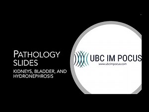POCUS Pathology: Kidneys, Bladder, and Hydronephrosis