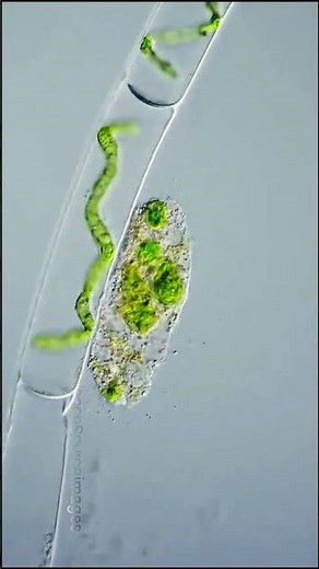 Vampire amoeba: The terror of the algae! #microorganisms #microbiology #curiosities