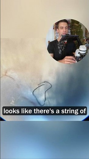 Pork Worms UNDER the Microscope