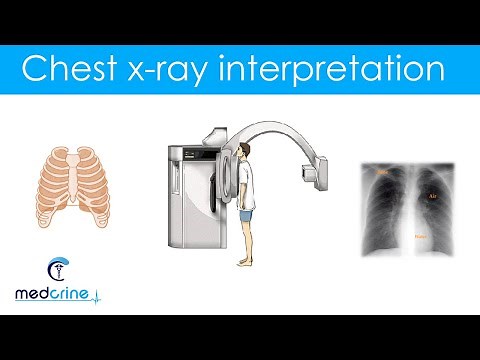 Basic Skills for Chest X-ray interpretation