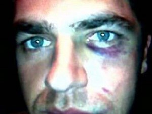 Cops Interpreted Sign Language as Threat, Handcuffed, Used Stun Gun, and Beat Deaf Man, Lawsuit Alleges