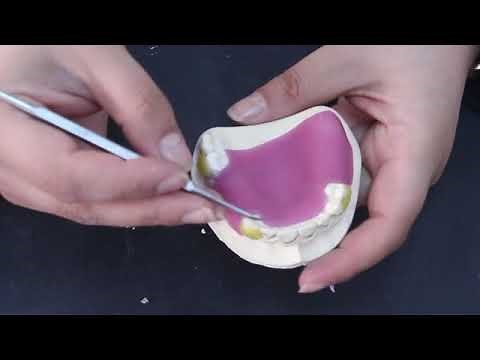 Lab # 5 Part 1 : Base Plate + Wax Rim