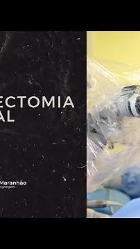 Petrosectomia subtotal