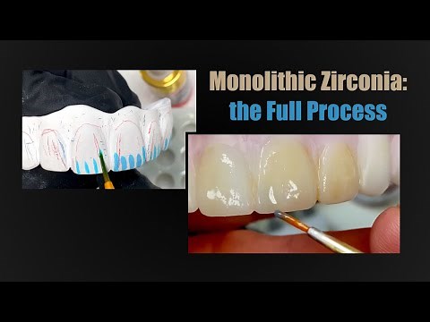 Monolithic Zirconia: The Full Process