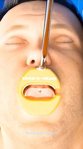 1.4M views · 5.8K reactions | How Stomach Reduction Surgery Works 樂 . . . #stomach #surgery #3d #animation #education #knowledge #facts #fb #zackdfilm #virals #facebookviral #fbyシvideo #facebookreel Zack D. Films Deepak Vishwakarma | Deepak Vishwakarma | Facebook