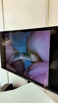 Just a few minutes to resize a ring