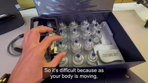 Watch Honest Review of Acuzone Premium Cupping Set on Amazon Live