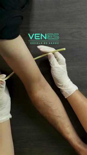 Dica de Ouro: Como Garrotear Corretamente