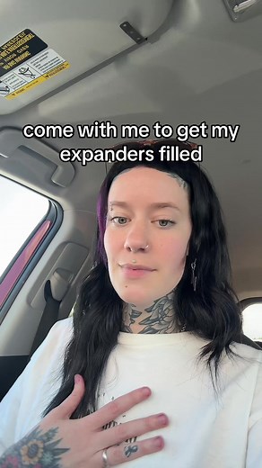 Expander Filling Process for Breast Reconstruction