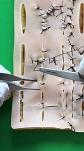 5.5K views · 51 reactions | Horizontal mattress stitch | Dermhacks | Facebook