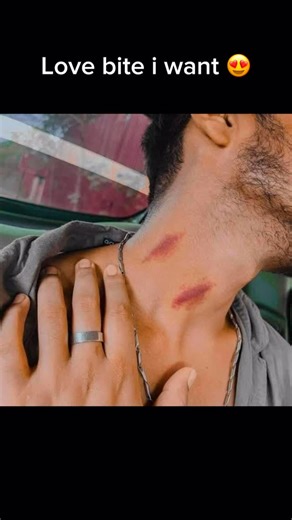 ROHIT SUNITA RAMESH METRI on Instagram: "Wait for end 🥲…. #lovebite #funny #work"