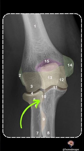 anatomía Radiológica del codo