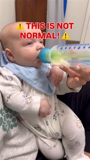 Speech and Feeding Therapy on Instagram: "✨Here 👇 comment “FEEDING” to get The Feeding Connections Collection — the same support we’re using to help this baby find what works best!✨ Bottle feeding shouldn’t feel this hard — and you don’t have to deal with it on your own. This baby was working so hard during feeds, with leaking, weakness, and needing extra support and compensations just to get through a bottle. 👶 Together, mom and I are figuring out what this baby needs — adjusting bottles and