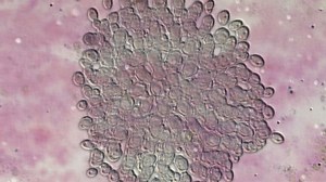 An animation imitating a view through a microscope, with a single microorganism self-replicating and multiplying into many identical copies (binary fission).