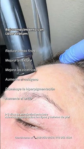 Erbium Laser Rejuvenation #rejuvenation #laser #co2laser