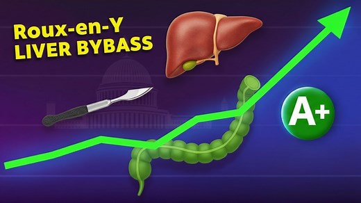 Learn about the Roux en Y Hepaticojejunostomy procedure, a complex surgical operation used to treat various conditions affecting the bile ducts and liver. This video aims to provide a comprehensive overview of the procedure, including its indications, benefits, and potential risks. Understanding the Roux en Y Hepaticojejunostomy procedure can help patients and their families make informed decisions about their care. The procedure involves creating a new pathway for bile to flow from the liver in