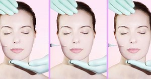 Contre les injections illégales, 200 médecins demandent l’interdiction de la vente en accès libre d’acide hyaluronique