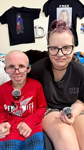 So Dakota shaved his head completely bald and even shaved off his eyebrows. His girlfriend joined in and shaved hers too. What do you guys think of the new look? | Korcle