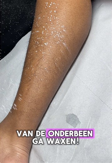 Lower leg wax❤️ Wil je ook minder haargroei? Stuur een Whatsapp naar 0639534795‼️ • • • ##Rotterdam#waxen#hairfree#summer#cleanskin#Softwax#hardwax#waxspecialist#beauty#lowerarm#schoonheidsspecialist#schoonheidssalon#stripwax#harsen#ommoord#lowerback#glowskin#lowerlegs#nohair#hairremoval#ommoord#kin#chin#upperlip#bovenlip#kin#mustache#roots#harsen#brazilianwax#vinger#fingerwax#wax#waxing