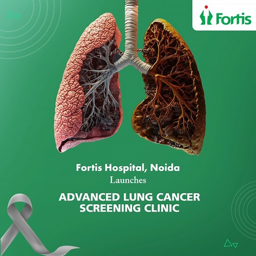 5.4K reactions | Fortis Noida launches the Advanced Lung Cancer...